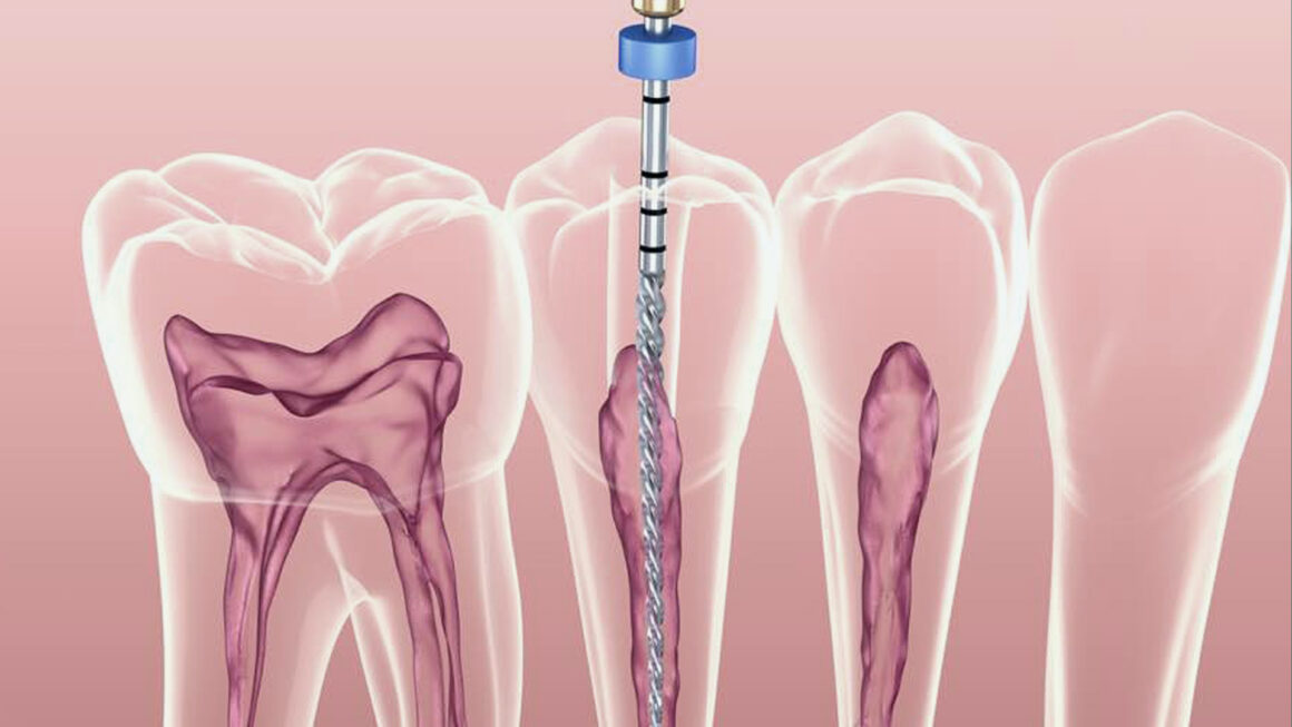 Endodontologie