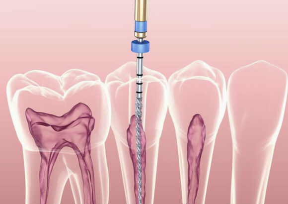 Endodontologie