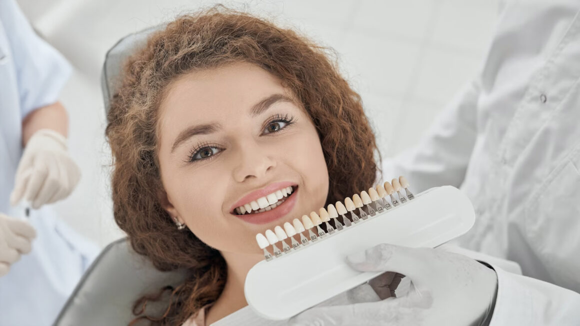 Veneers (Hollywood Smile)