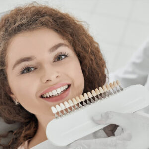 Veneers (Hollywood Smile)